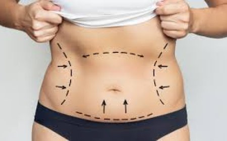 How Tummy Tuck in Dubai Can Boost Your Confidence and Self-Image
