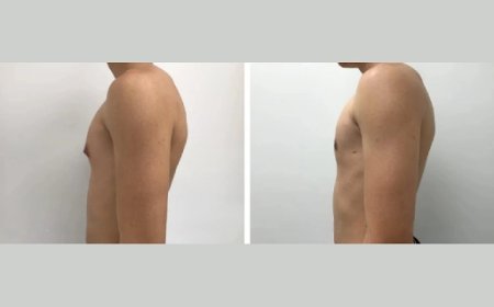 Virtual Consultations for Gynecomastia Surgery in Dubai