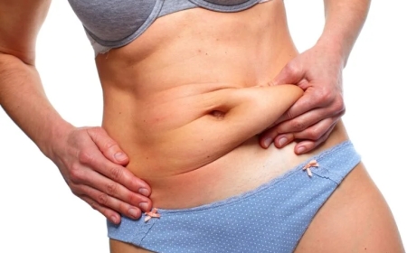 Best Fat Transfer Surgeons in Dubai for Breast Augmentation: What You Should Know