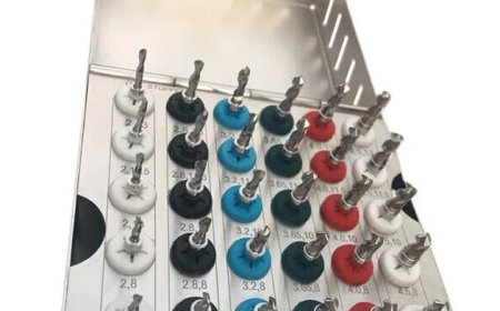 A Buyer’s Guide to Affordable and Reliable Dental Implant Supplies