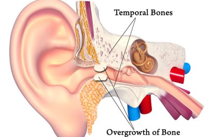 How a Surfers Ear Surgeon in Ventura Also Helps Tackle Sleep Apnea