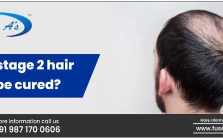 Stage 2 Hair Loss Treatment | PRP Hair Treatment Price